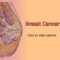 Breast Cancer – Animated Powerpoint Template ~ Free Medical Within Breast Cancer Powerpoint Template