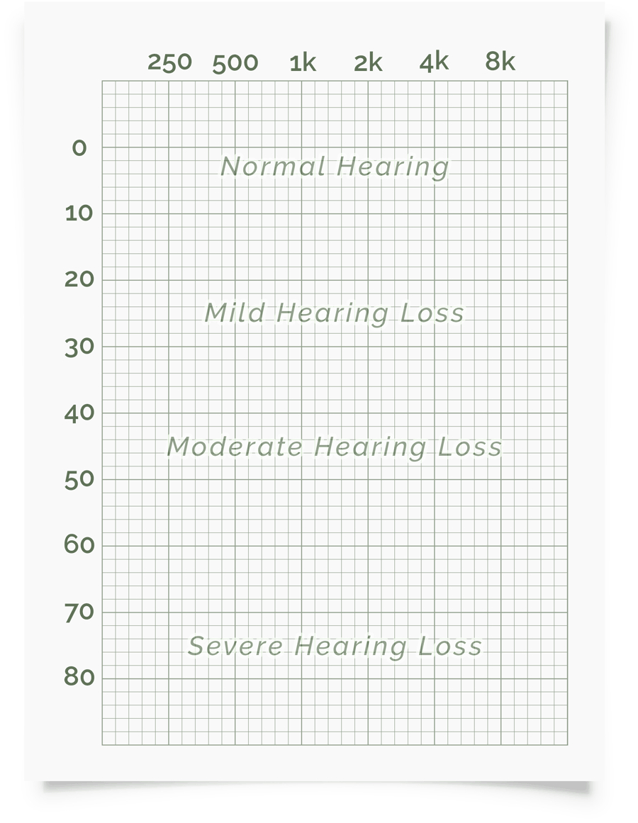 Online Hearing Test & Audiogram Printout In Blank Audiogram Template Download